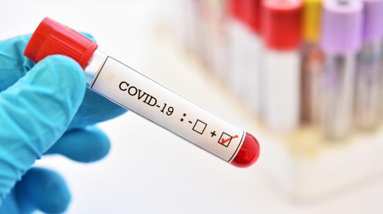 test tube labled covid 19 in a lab setting