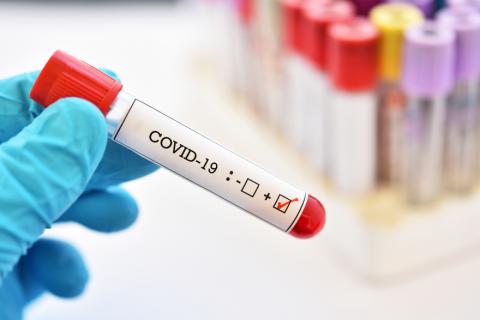 test tube labled covid 19 in a lab setting